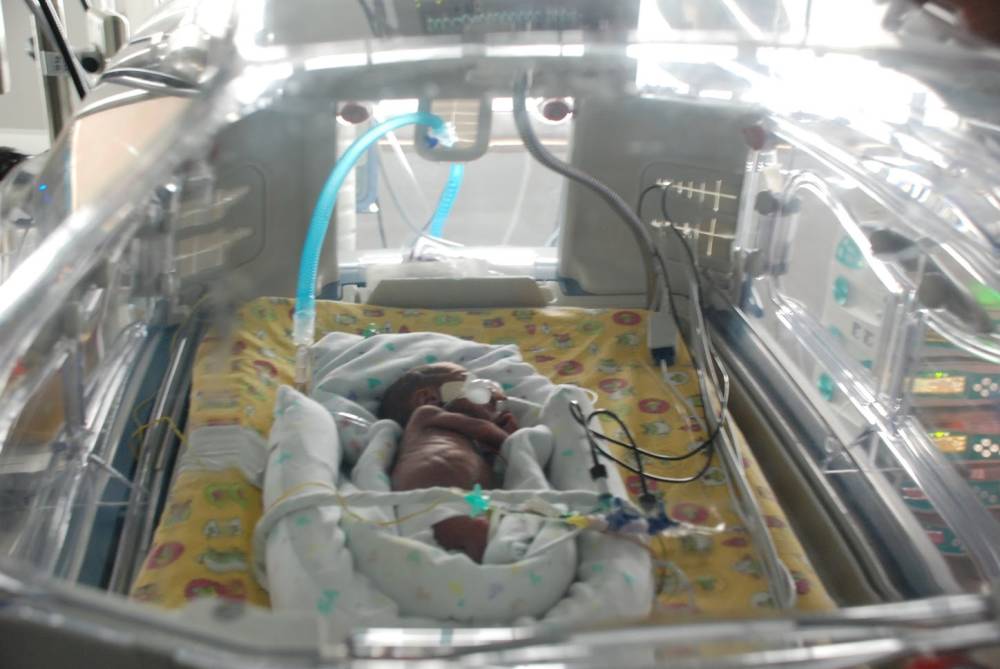 Sara Infante's newborn son Estêvão in the NICU.